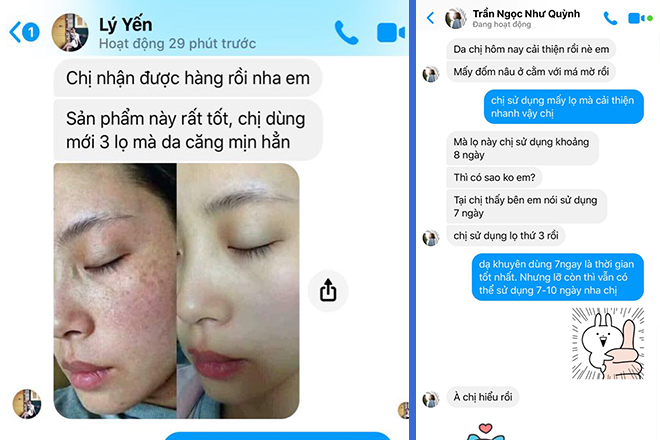 Danh gia tu khach hang - Review serum giữ ẩm chống lão hóa Hanvely chi tiết nhất dành cho bạn